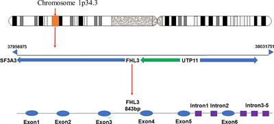 The Roles of FHL3 in Cancer